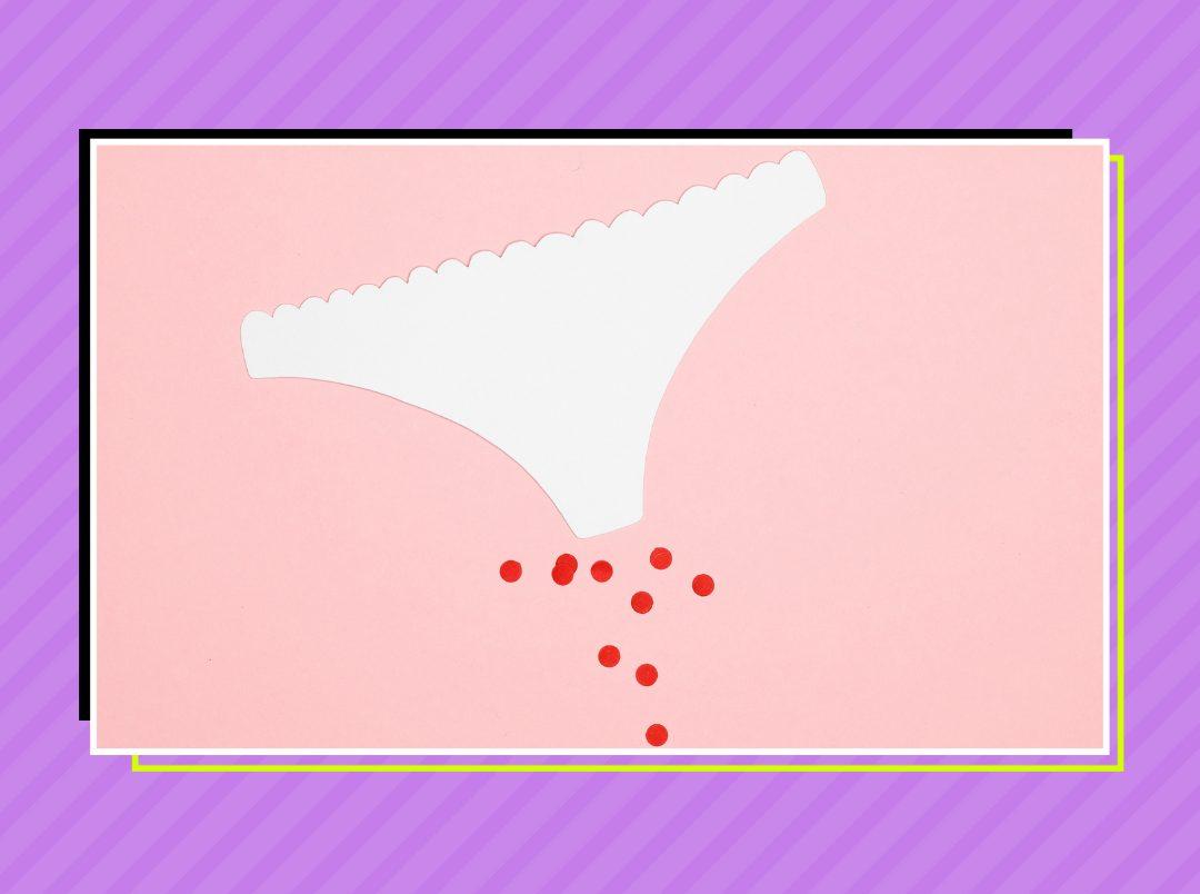 Bloody Hell! How To Remove Period Stains Like A Pro￼
