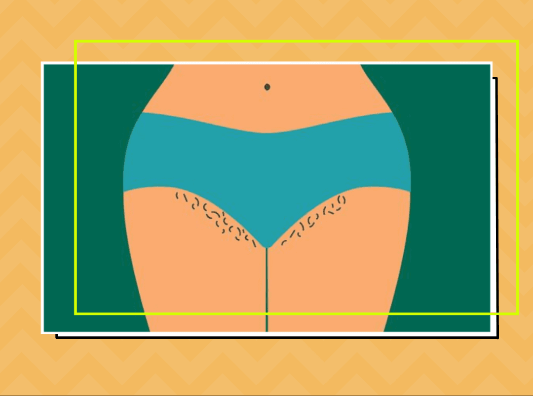 Shaving, Waxing Or Hair Removal Creams? Everything You Need To Know About Pubic Hair Removal