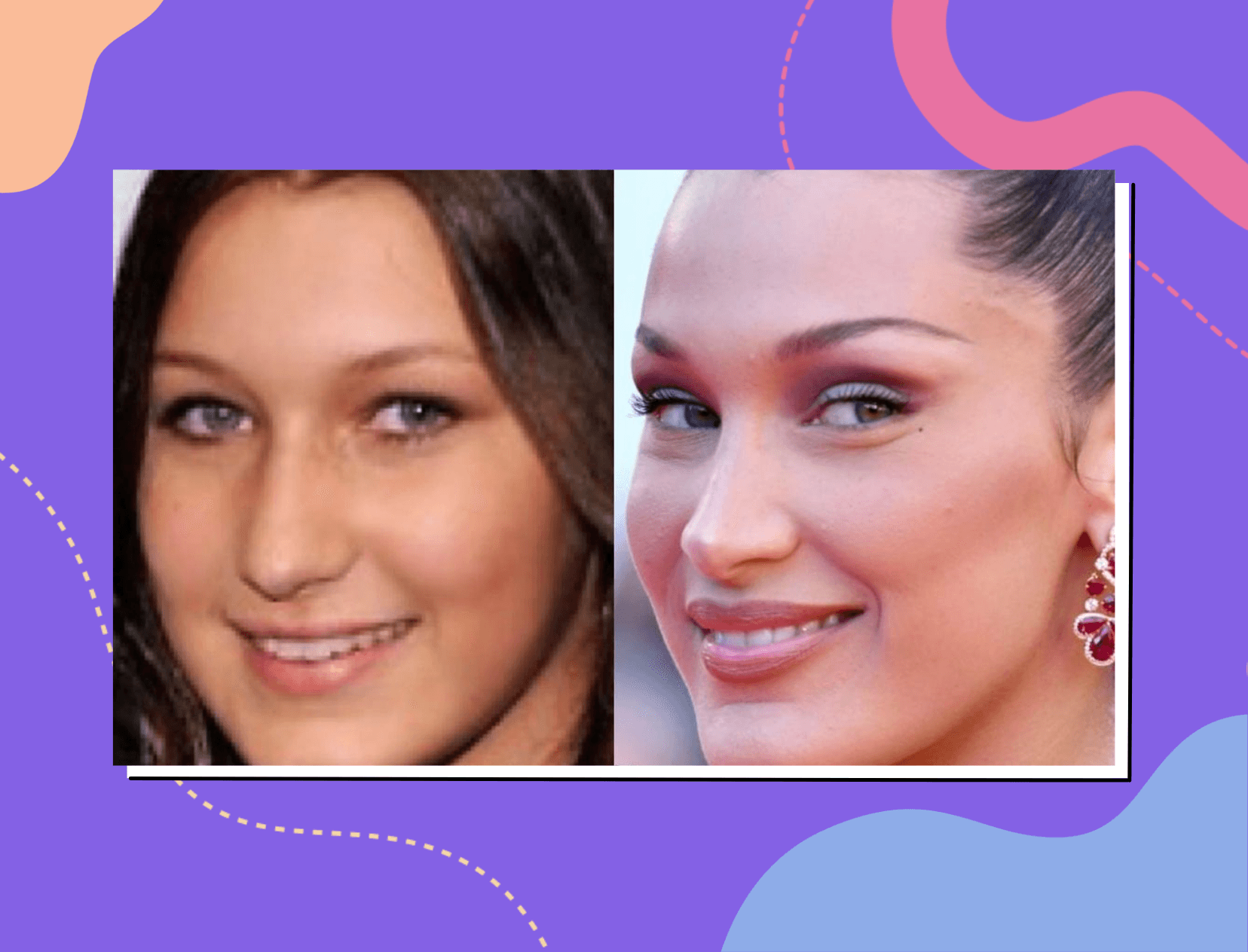 Here&#8217;s Why Bella Hadid Regrets Getting A Nose Job