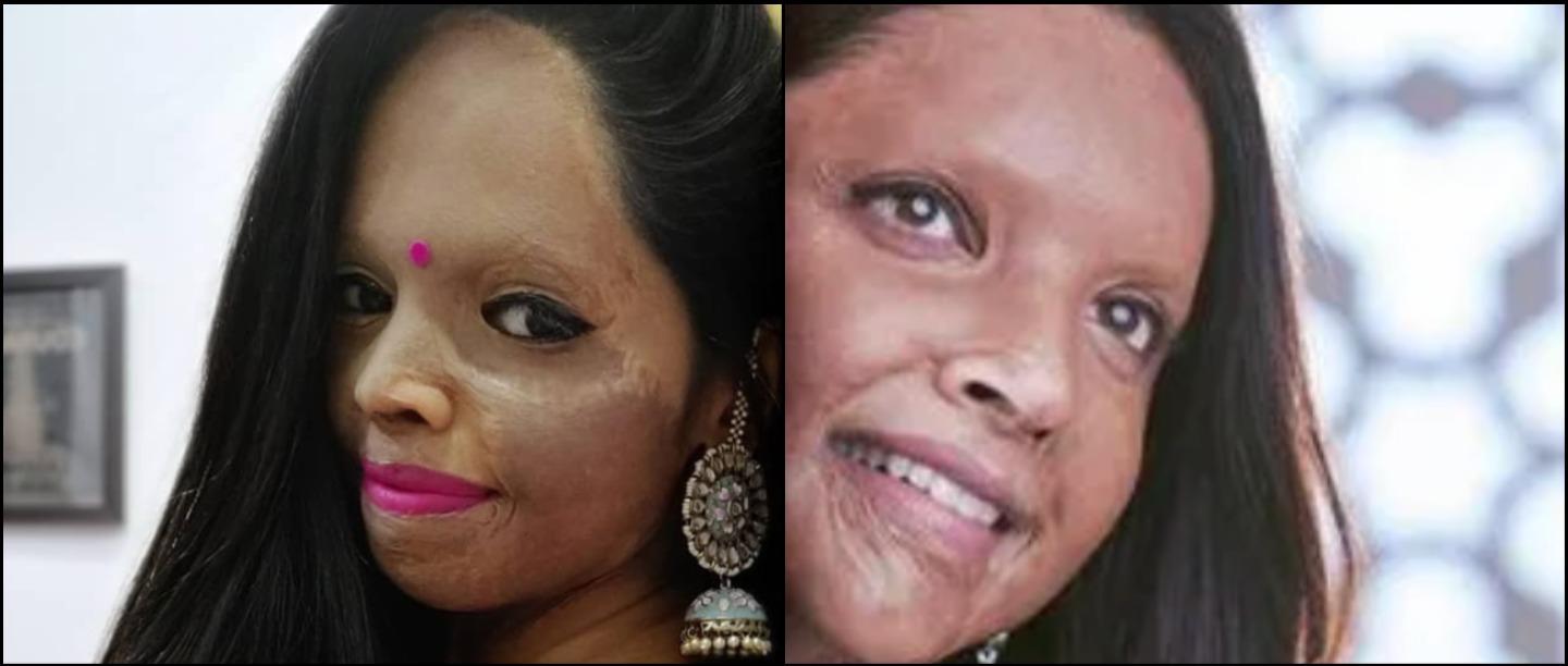 Acid Attack Survivor Laxmi Agarwal Denies Being Paid Rs 13 Lakh For Her Biopic Chhapaak