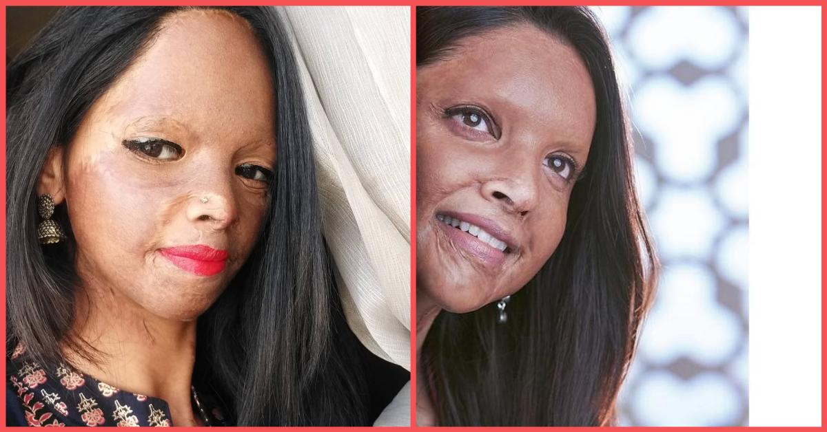 This Is The Story Of Laxmi Agarwal, The Acid Attack Survivor Deepika Is Playing In Chhapaak