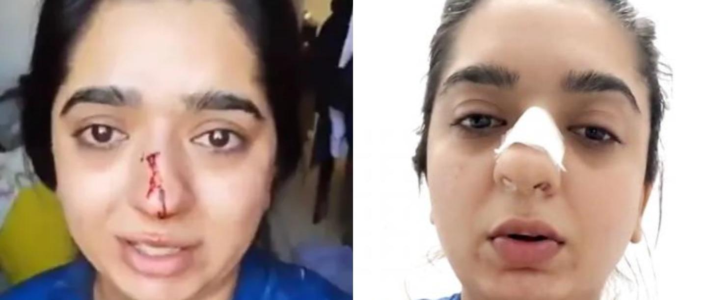 He Screamed &amp; Punched Me: B&#8217;lore Woman On How Zomato Delivery Exec Attacked Her
