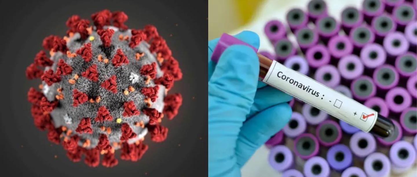 8 COVID-19 Symptoms You Should Know About Before You Decide To &#8216;Brave&#8217; The Virus