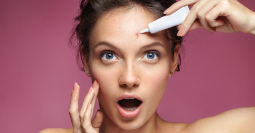 Woke Up With A Pimple Just Days Before Your Wedding? 9 Quick Fixes You Should Know!