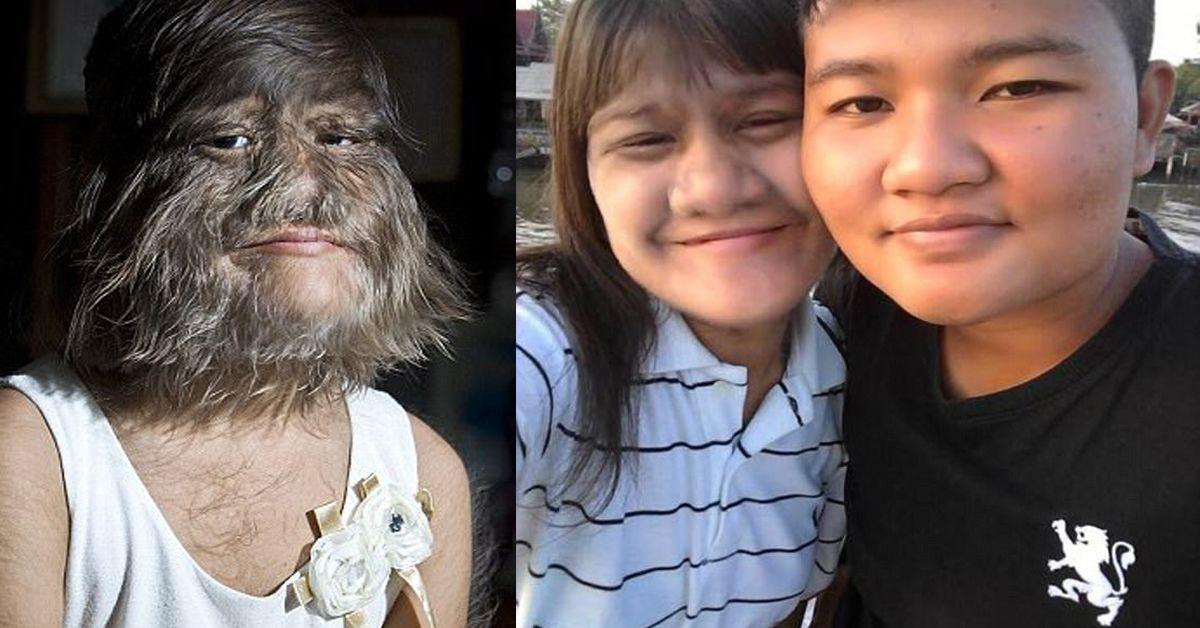 Meet The World&#8217;s Hairiest Girl &amp; Let Her Show You Love Has Nothing To Do With Looks