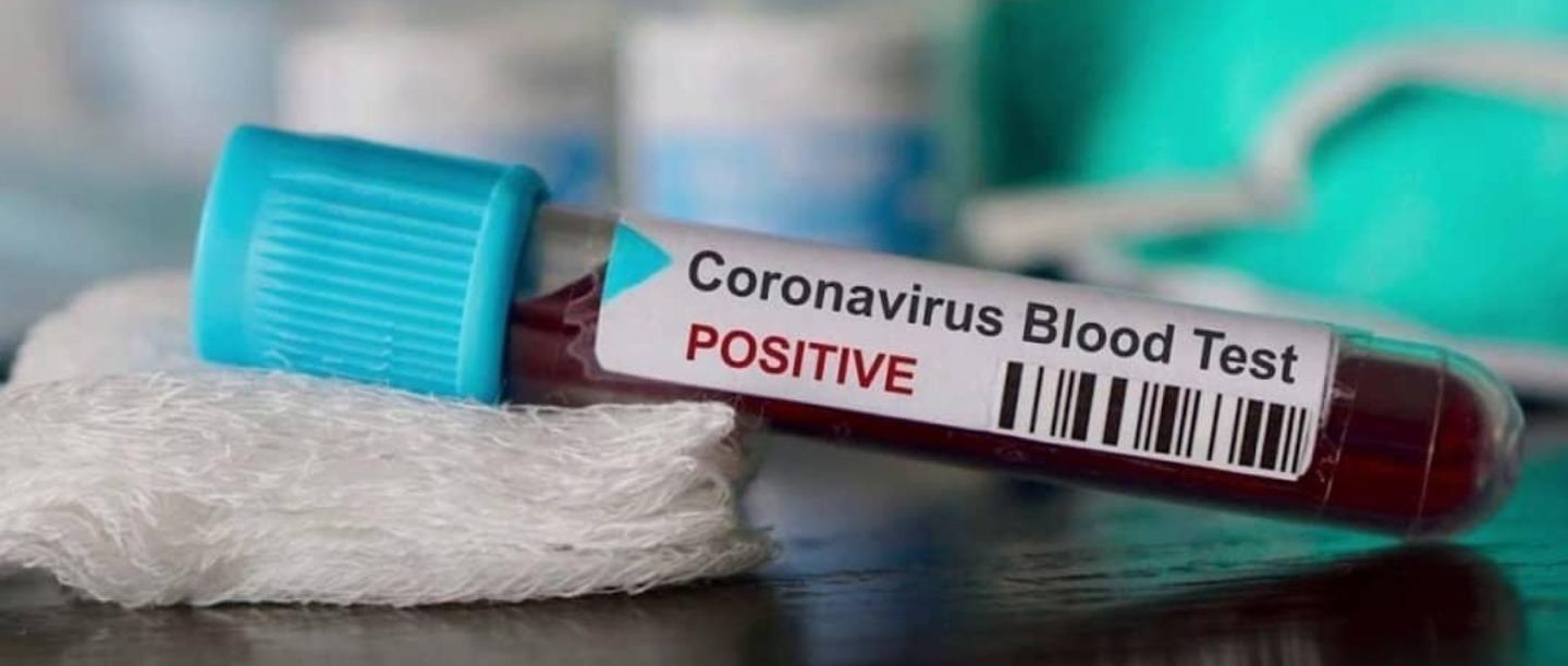 It Was Unexpected: Delhi Doctor Shares Recovery From Asymptomatic Coronavirus Infection