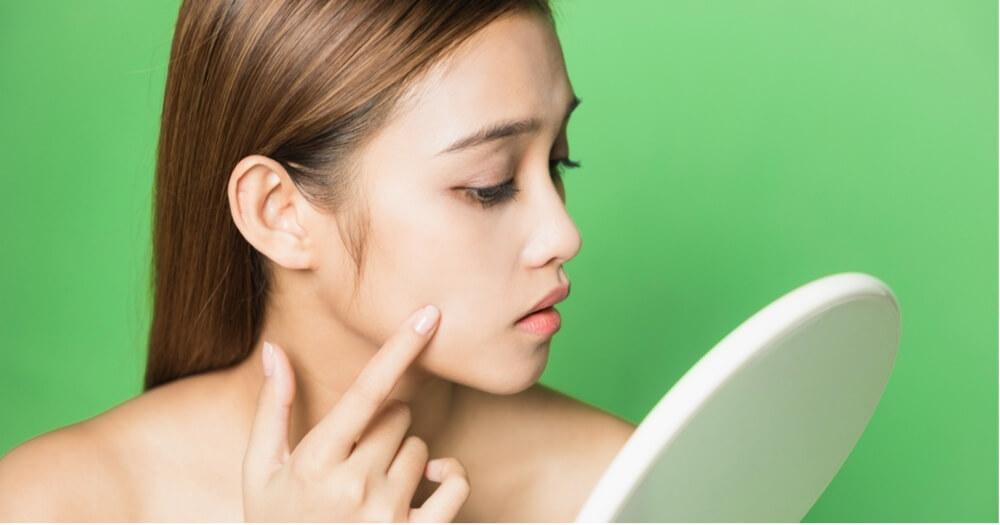 These Home Remedies Are Perfect To Lighten Brown Spots