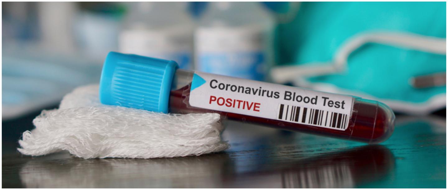 Can Hot Weather Kill Coronavirus? &amp; Other COVID-19 Myths You Should Not Fall For
