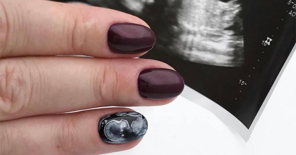 To-Be Mamas, This Is How You Can Always Have Your Ultrasound With You!