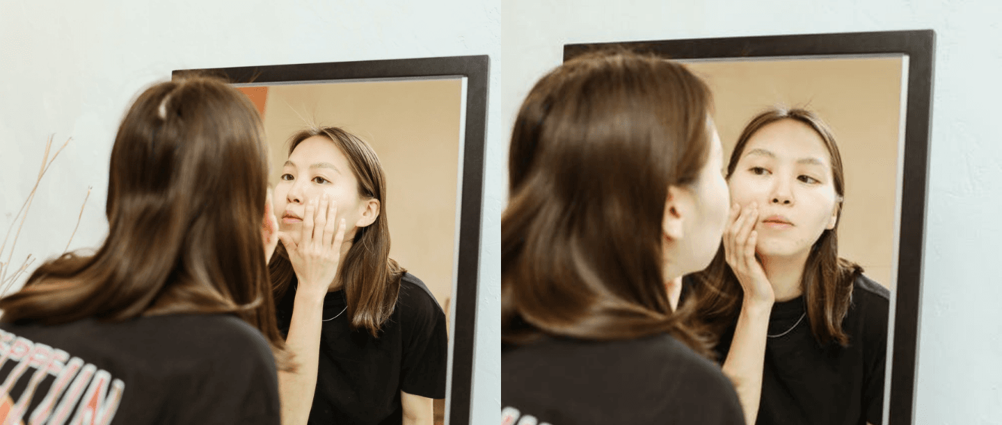 Don&#8217;t Do It! An Easy Guide On How To Stop Yourself From Picking At Your Skin