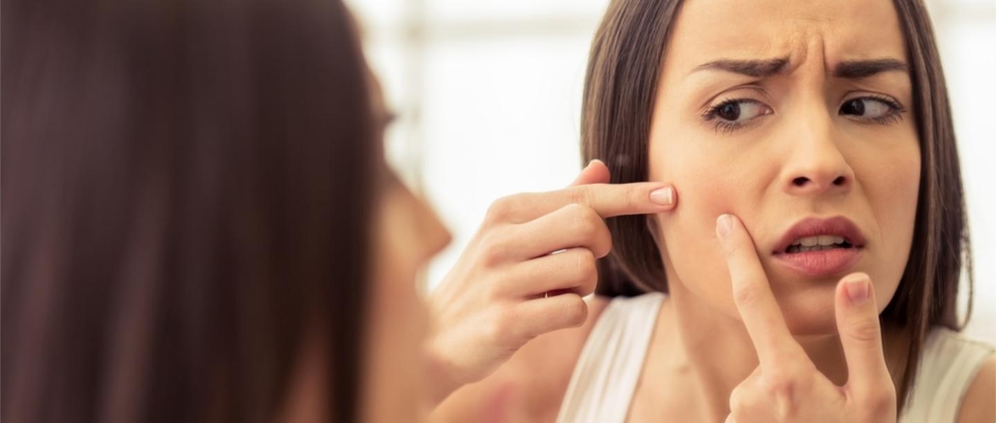 Don&#8217;t Touch That Pimple! 5 Scary Things That Happen When You Pop Your Zits