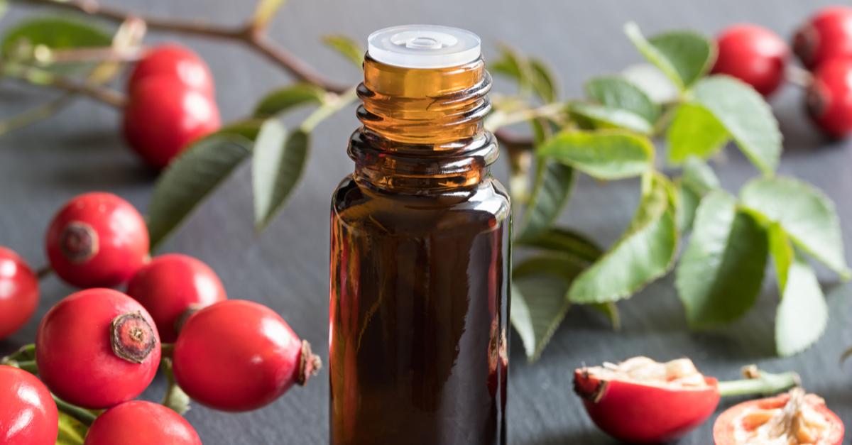 It&#8217;s An Essential (Oil): 11 Benefits Of Rosehip Seed Oil For Your Skin, Hair And Nails!
