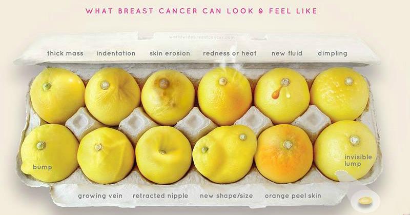 What Breast Cancer Can Look &amp; Feel Like &#8211; You NEED To Know This!