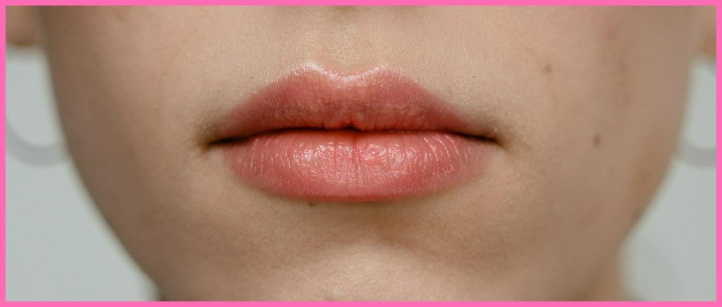 Popular Lip-Plumping Fads That Boast Of A Fuller &amp; Smoother Pout