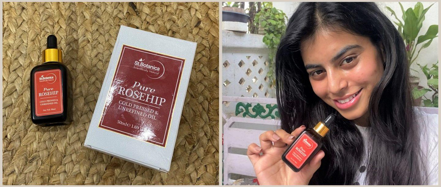 #POPxoReviews: Rosehip Oil Is My New Haircare BFF &amp; Here&#8217;s Why You Should Try It Out