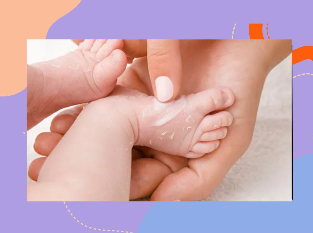 7 Home Remedies For Your Baby’s Dry Skin That Work Effectively During The Colder Months