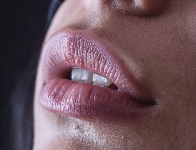 Treating Lip Pigmentation Is As Simple As It Gets With This Method