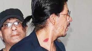 8 Times Bollywood Celebs Flaunted Their Hickeys!